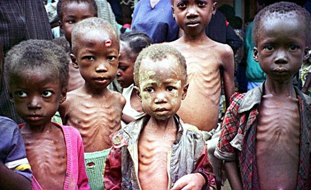 Afrikalı çocuklar açlıktan ölme tehlikesi yaşarken, batılı ülkelerde ise durum tam tersi.