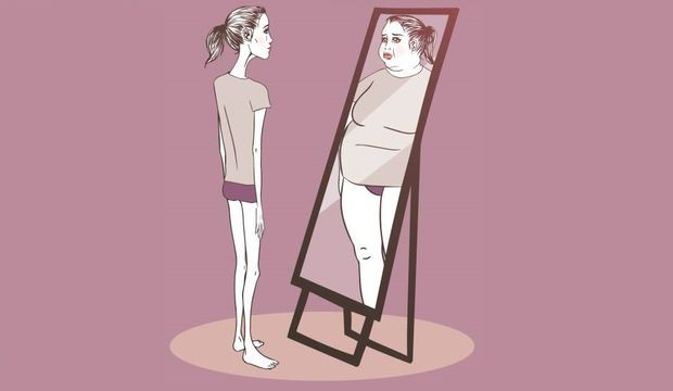 Bu rahatsızlığa yakalanan hastalar, kendilerini olduğundan daha kilolu olarak düşünüyorlar.