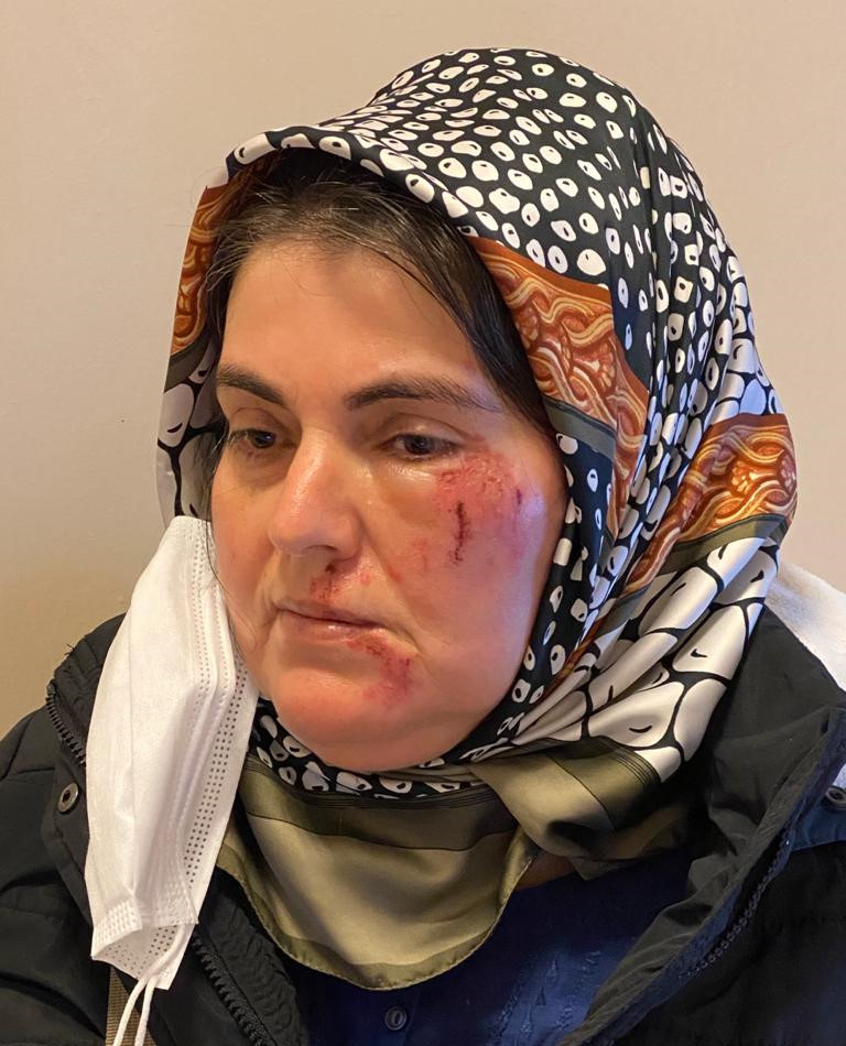Maltepe'de alışverişten dönen kadına feci saldırı: Neye uğradığını şaşırdı